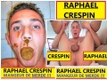 Crespin raphael 4 